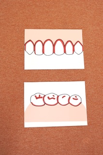 歯のイラスト